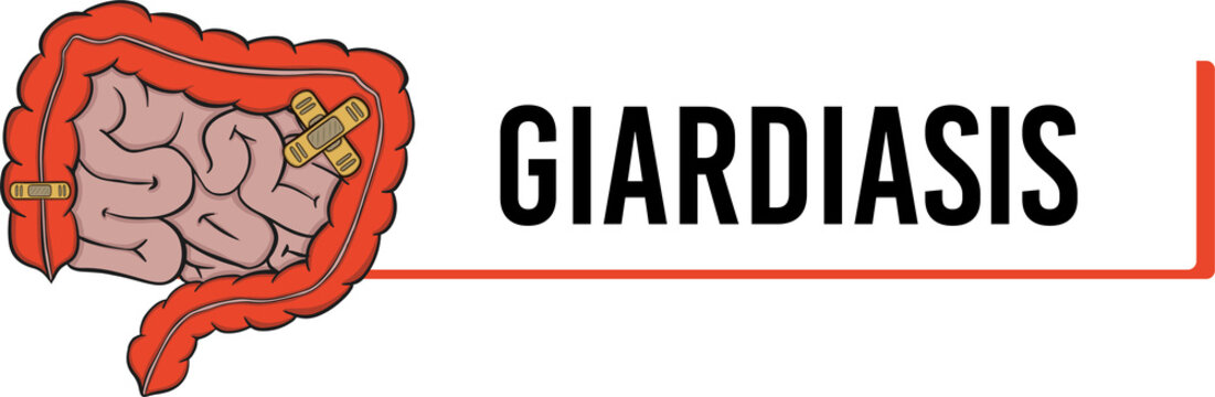 giardiasis