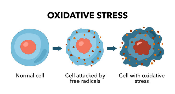 Oxidative stress diagram vector illustration design, Oxidative stress. From Normal cells to Oxidative stress and aggressive free radicals, cell death. Vector diagram for your design, educational