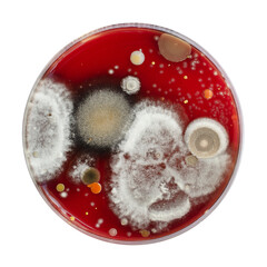 Mold fungi colonies grown from indoor air on blood sheep agar
