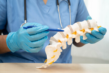 Asian doctor holding spinal nerve and bone model, Lumbar spine displaced herniated disc fragment...