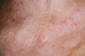 Fototapeta premium Cats may also have multiple, small crusty bumps,hair loss on both sides of the body or areas of flat, reddened, swollen skin called eosinophilic plaques