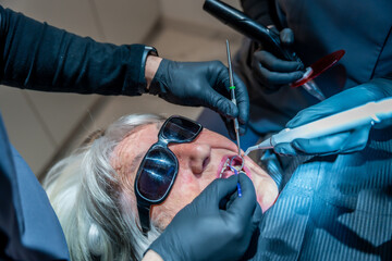Dentists performing teeth whitening procedure on senior woman
