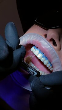 Dentist carefully applying whitening gel on patient's teeth, enhancing their smile with professional dental care