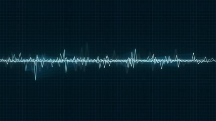 Animated ECG Waveform Monitor on Digital Grid – Futuristic Heartbeat EKG Line in Motion