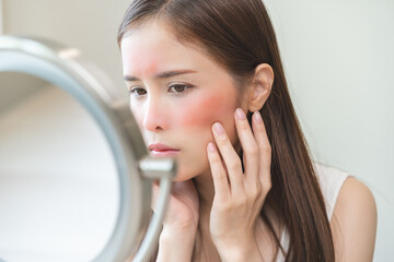 Dermatology, scratch asian young woman looking at mirror, expression worry and itch, itchy allergy...