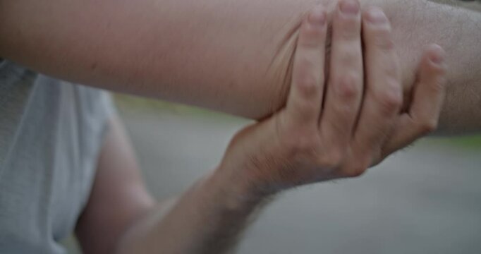 Man examines an elbow scar, reflecting on recovery, healing, and the journey to physical well-being after injury.