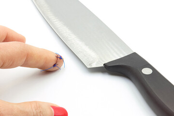 Finger with stitches. Cut with a knife in the kitchen. Home accidents. Insurance