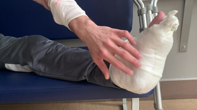 Man with a broken leg is being treated in hospital.