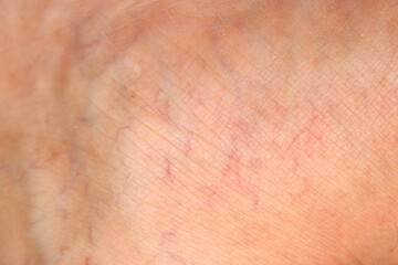 Naklejka premium Detailed Close-Up of Skin Texture with Patterns and Red Lines