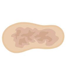 Melasma Skin Pigmentation. Dark Spot Treatment Illustration Design.