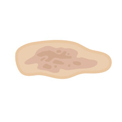 Melasma Skin Pigmentation. Dark Spot Treatment Illustration Design.