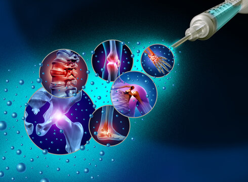 Regenerative Joint pain Medicine and Stem cell treatment or DNA biotechnology medication to repair joints and stop degenerative aging as a multicellular embryonic cellular therapy.