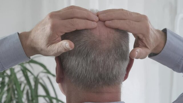 Rear view older man with bald patches on scalp, showing signs alopecia and age-related hair thinning, Anti-aging treatments for balding men, hair loss