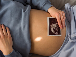 Ultrasound image gently placed on belly as expectant mother rests in peaceful room. Ultrasound...