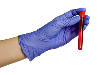 Doctor in medical glove holding test tube with blood sample on white background, closeup