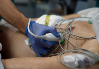 Doctor using ultrasound scanner on patient's chest during medical procedure
