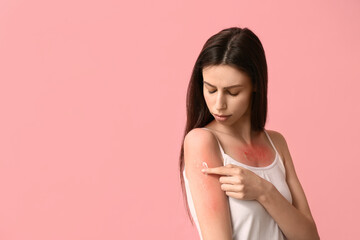 Beautiful young woman with red sunburned skin applying cream on pink background