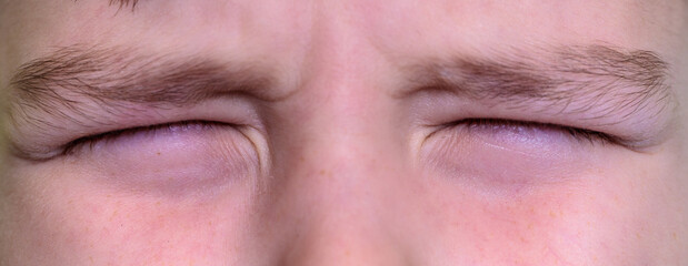 boy with closed eyes. close-up part of face