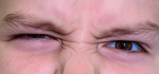 The boy squinted one eye and looked at the camera. Close-up of part of the face