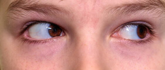 boy looking away with his eyes. close-up part of face