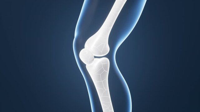 Human kneecap model, arthrophlogosis, joint swelling, joint pain, Biological and medical concepts, 3d rendering.