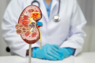 Chronic kidney disease, doctor with model for treatment urinary system, urology, Estimated...