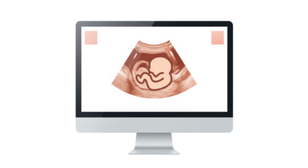 Isolated Ultrasound Scan of Fetus on Monitor Screen