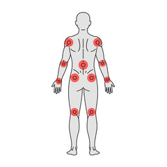 Human Body Pain Zones: A detailed visual representation, pinpointing the potential areas of discomfort, designed for medical and wellness contexts.