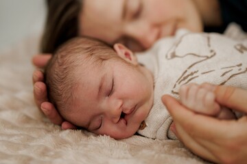 Newborn Baby with Cleft Lip Sleeping Peacefully