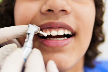 Dentist performing teeth polishing procedure on young patient using professional equipment, ensuring oral hygiene and health