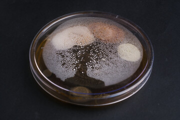 Diverse fungal colonies growing on nutrient agar