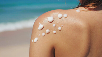 Sun Protection Application: A close-up shot showcases a person's shoulder, artfully adorned with dabs of sunscreen, ready to shield against the sun's rays on a beautiful beach day. 