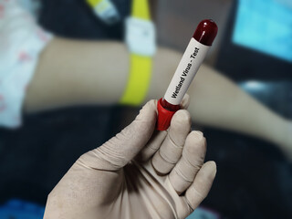 Naklejka premium Doctor holds blood samples for Wetland virus test in the hospital background.