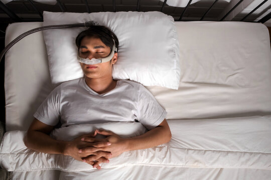 Top view of a man sleeping with CPAP nasal mask in bed, used for snoring and obstructive sleep apnea (OSA) therapy. A quiet, effective solution to improve nighttime breathing and health.