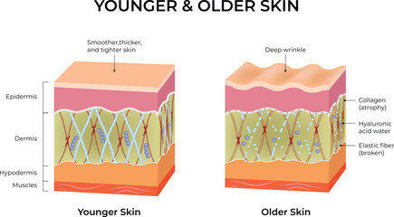 Comparison of Younger and Older Skin Structures and Aging Effects Vector Illustration