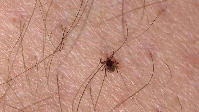 Parasitic Tick Crawling on Human Skin Searching for Feeding Spot