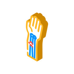 broken arm fracture injury isometric icon vector illustration
