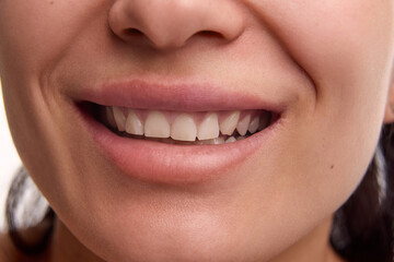 Close-up cropped image of female spotless, clear face, white teeth and plump lips. Woman smiling....