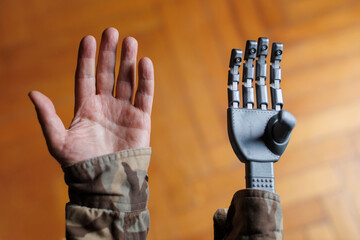 Disabled military veteran showing prosthetic hand