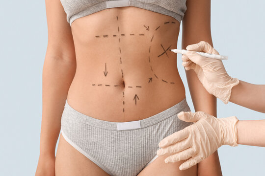 Tummy Tuck Surgery Images – Browse 4,290 Stock Photos, Vectors, and Video |  Adobe Stock