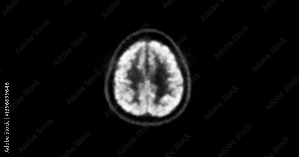 Poster a pet-mri scan of the brain, highlighting areas of neural activity and providing valuable insights f