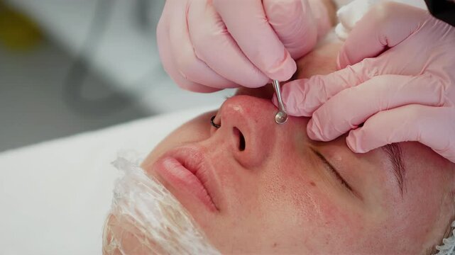 Beautician cosmetologist doing deep pore cleansing on client using blackhead removal tool. Professional skin care procedure performed during advanced facial treatment. Woman lying relaxed enjoying