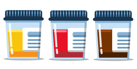 Laboratory containers with dark caps. Medical sample of urine, blood, and feces in glass tubes isolated on white background. Suitable elements for medical laboratory, biochemistry and medical analysis