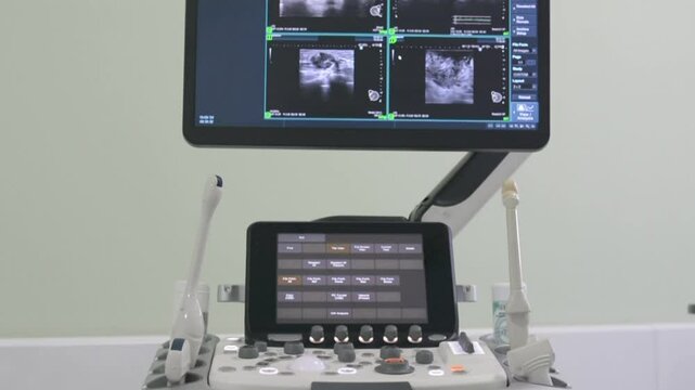 Ultrasound machine in a hospital or at an exhibition.