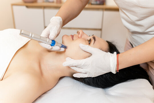 Cosmetologist doing microneedling, patient care using dermapen in a beauty salon