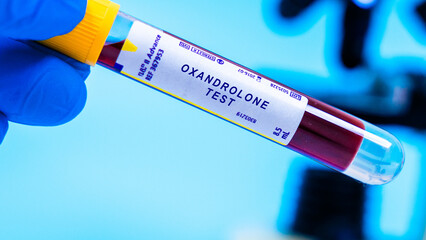 Obraz premium Screens for oxandrolone, an anabolic steroid used to promote