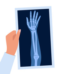 XRayBonesDoctorHand2-10.eps