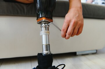 Man amputee with prosthetic leg disability on above knee transfemoral leg prosthesis artificial...