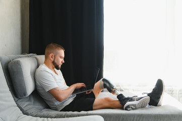 Man amputee with prosthetic leg disability on above knee transfemoral leg prosthesis artificial...