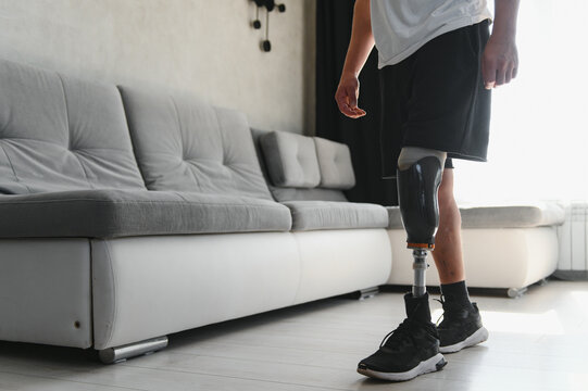 Man amputee with prosthetic leg disability on above knee transfemoral leg prosthesis artificial device at home. People with amputation disabilities everyday life